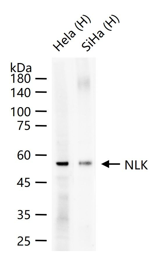 NLK Antibody in Western Blot (WB)