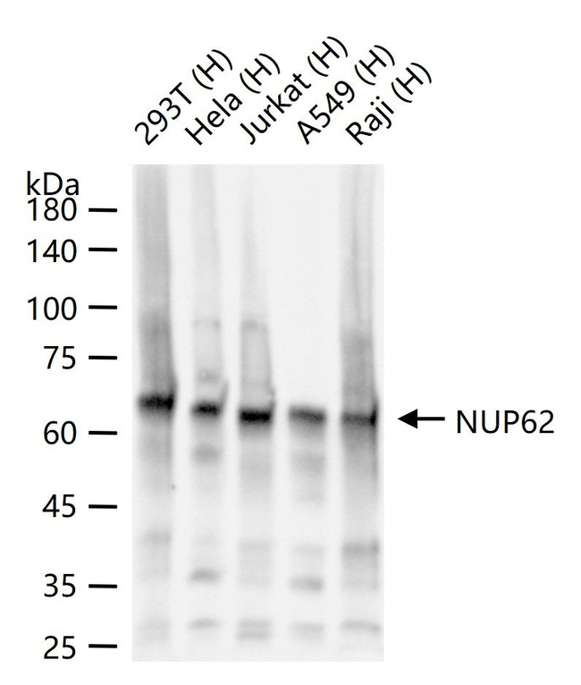 NUP62 Antibody in Western Blot (WB)