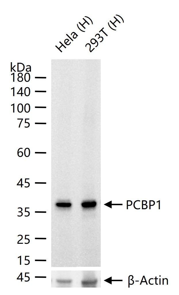 PCBP1 Antibody in Western Blot (WB)