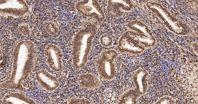 CIRBP Antibody in Immunohistochemistry (Paraffin) (IHC (P))