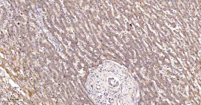 ACSL4 Antibody in Immunohistochemistry (Paraffin) (IHC (P))