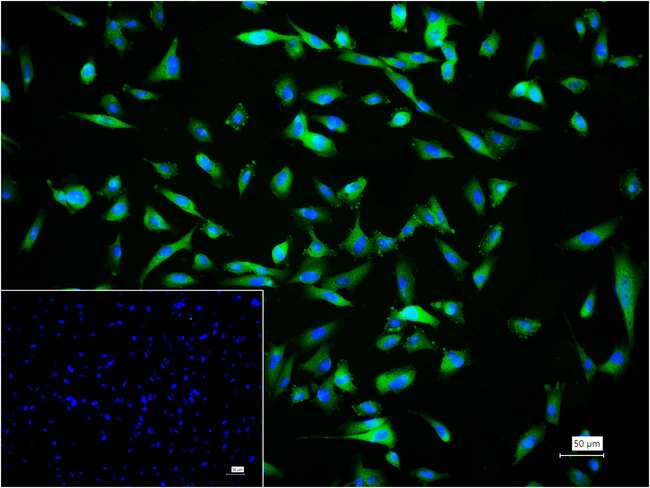 CARS Antibody in Immunocytochemistry (ICC/IF)