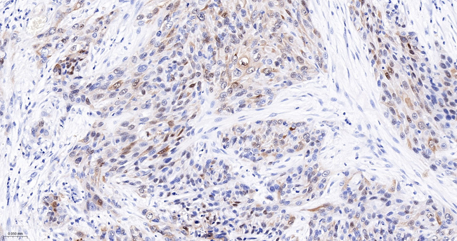 SERPINB3 Antibody in Immunohistochemistry (Paraffin) (IHC (P))