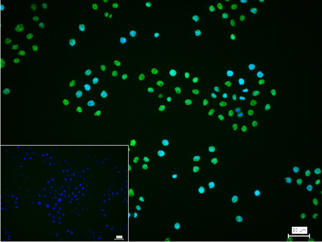 CtBP2 Antibody in Immunocytochemistry (ICC/IF)