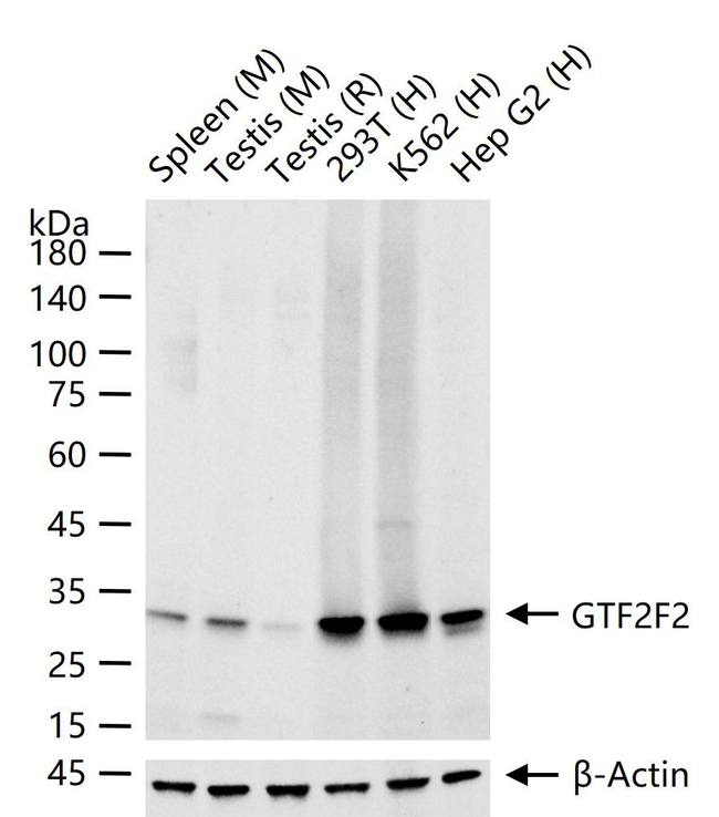 GTF2F2 Antibody in Western Blot (WB)