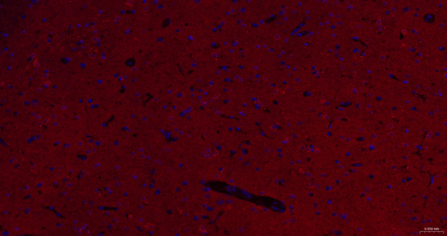 NCS1 Antibody in Immunohistochemistry (Paraffin) (IHC (P))