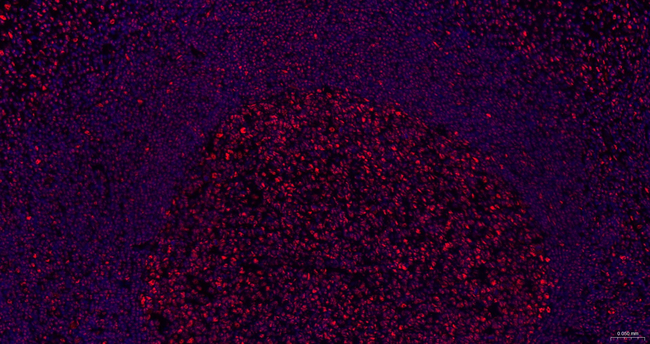 SNRPA1 Antibody in Immunohistochemistry (Paraffin) (IHC (P))
