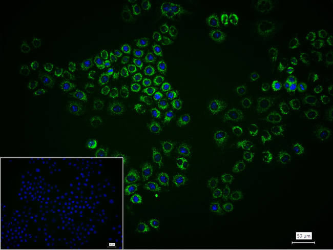 ACAA2 Antibody in Immunocytochemistry (ICC/IF)