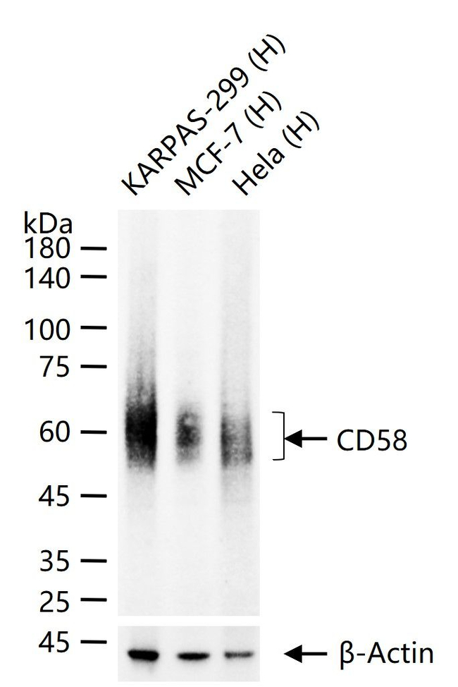 CD58 Antibody in Western Blot (WB)