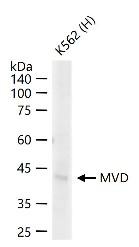 MVD Antibody in Western Blot (WB)