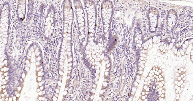 TNFRSF11B Antibody in Immunohistochemistry (Paraffin) (IHC (P))