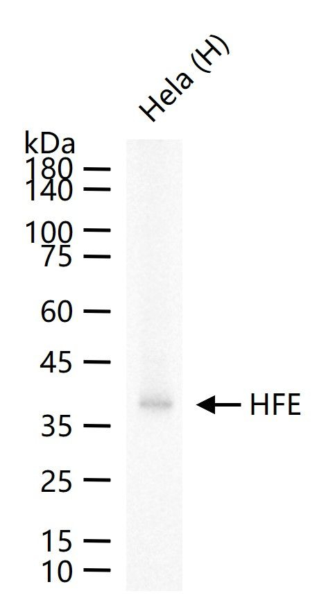 HFE Antibody in Western Blot (WB)