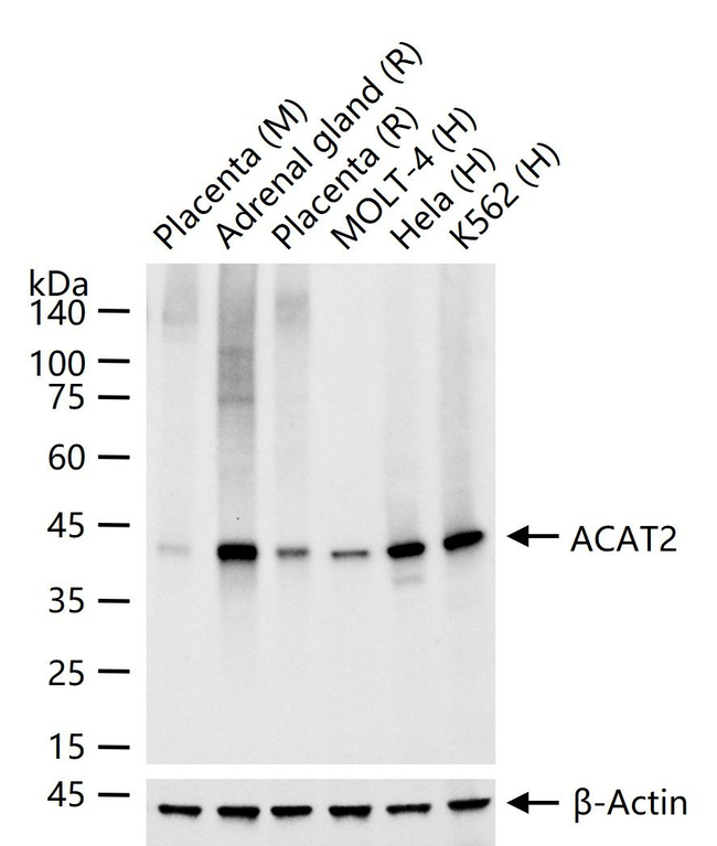 ACAT2 Antibody in Western Blot (WB)