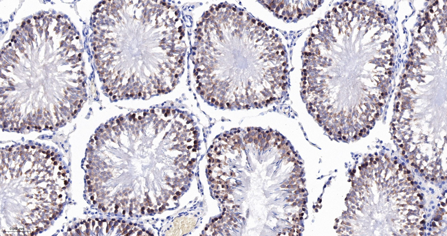 RASA1 Antibody in Immunohistochemistry (Paraffin) (IHC (P))