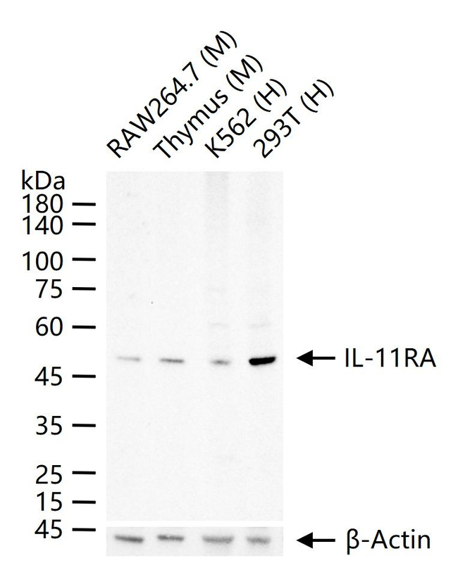 IL11RA Antibody in Western Blot (WB)