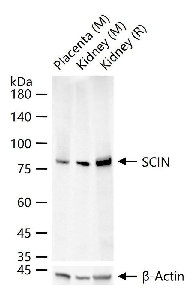 SCIN Antibody in Western Blot (WB)