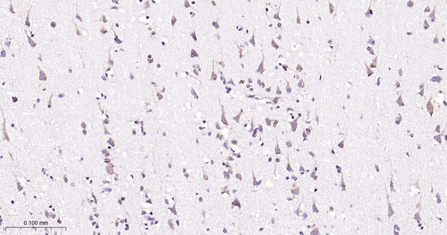 TXNDC12 Antibody in Immunohistochemistry (Paraffin) (IHC (P))