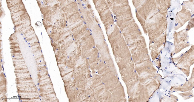 MRLC2 Antibody in Immunohistochemistry (Paraffin) (IHC (P))