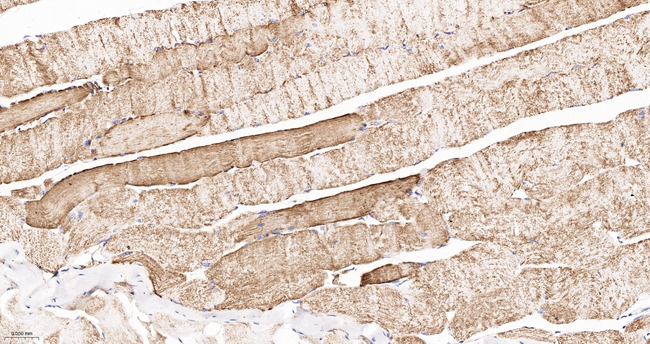 UQCRH Antibody in Immunohistochemistry (Paraffin) (IHC (P))