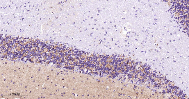 STX16 Antibody in Immunohistochemistry (Paraffin) (IHC (P))
