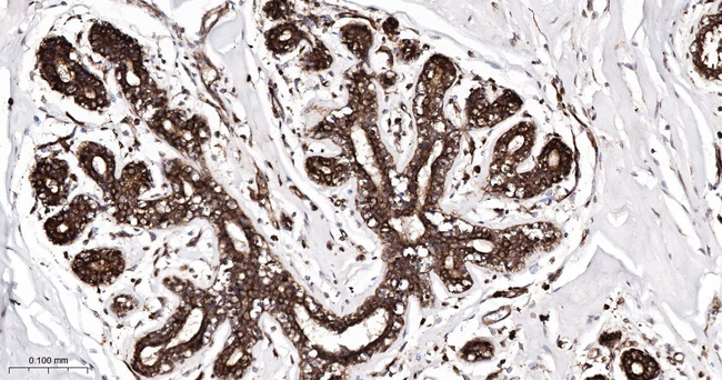 TRPV5 Antibody in Immunohistochemistry (Paraffin) (IHC (P))
