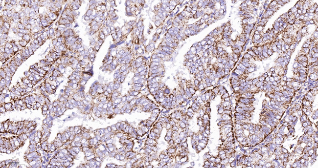 Kallikrein 8 Antibody in Immunohistochemistry (Paraffin) (IHC (P))