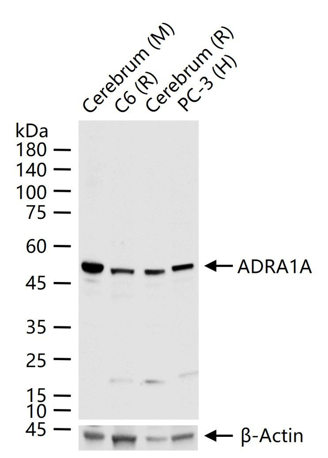 alpha-1a Adrenergic Receptor Antibody in Western Blot (WB)