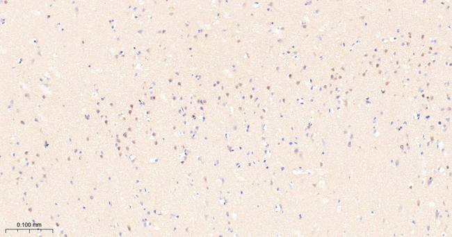 ALS2CR1 Antibody in Immunohistochemistry (Paraffin) (IHC (P))