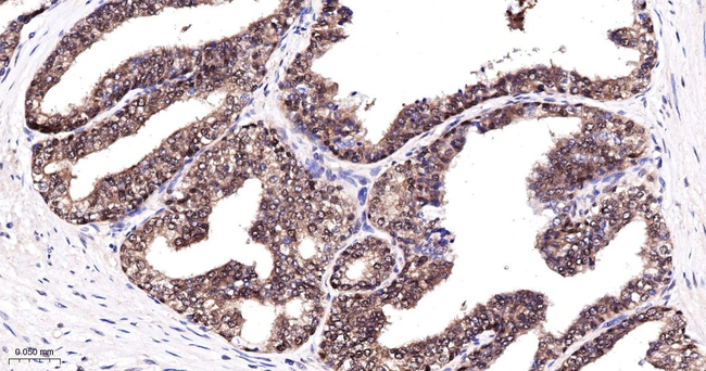 BAG1 Antibody in Immunohistochemistry (Paraffin) (IHC (P))