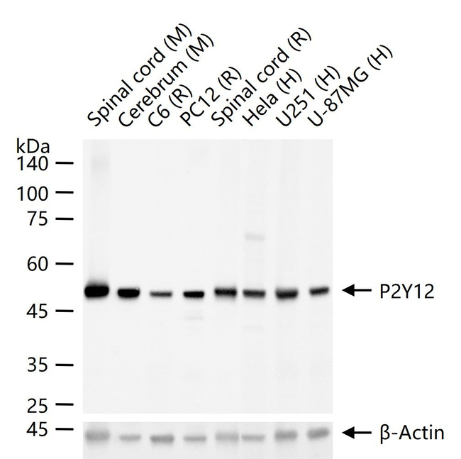 P2Y12 Antibody in Western Blot (WB)