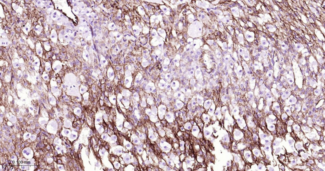 CD141 Antibody in Immunohistochemistry (Paraffin) (IHC (P))