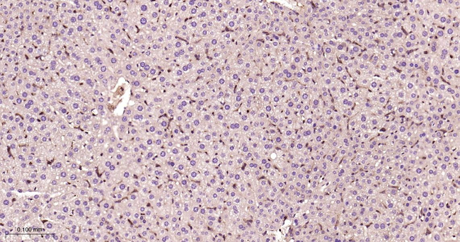 RAB5C Antibody in Immunohistochemistry (Paraffin) (IHC (P))