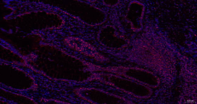 ALDH7A1 Antibody in Immunohistochemistry (Paraffin) (IHC (P))