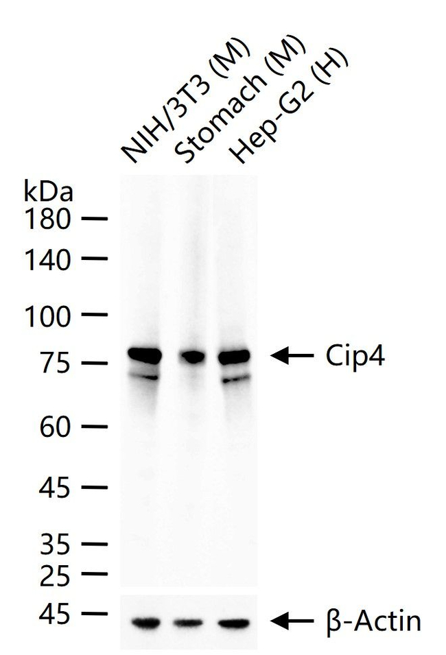 TRIP10 Antibody in Western Blot (WB)