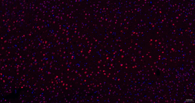 COPS8 Antibody in Immunohistochemistry (Paraffin) (IHC (P))
