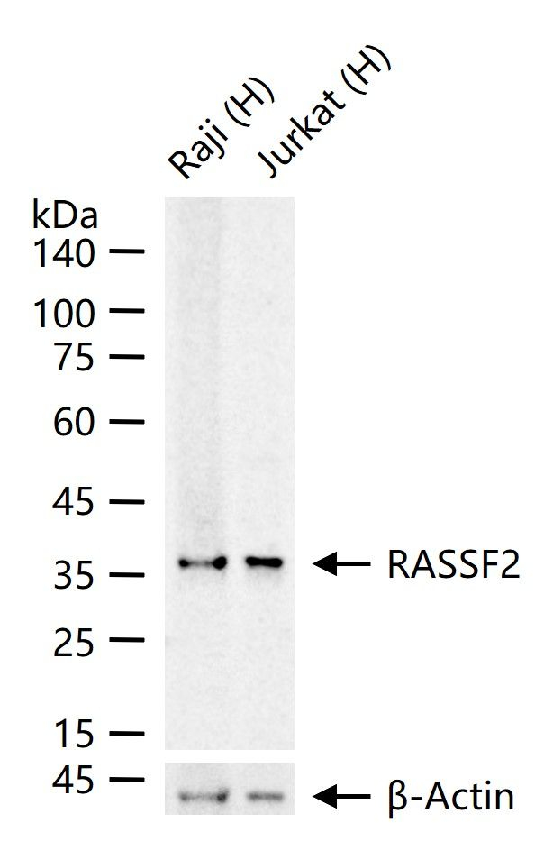 RASSF2 Antibody in Western Blot (WB)