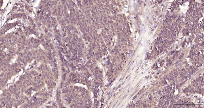 MTAP Antibody in Immunohistochemistry (Paraffin) (IHC (P))