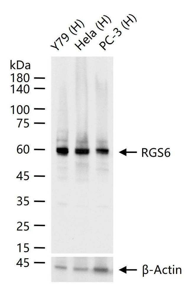 RGS6 Antibody in Western Blot (WB)