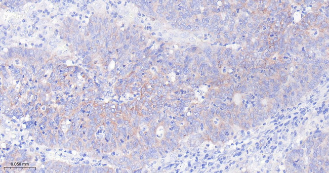 IGF2BP2 Antibody in Immunohistochemistry (Paraffin) (IHC (P))