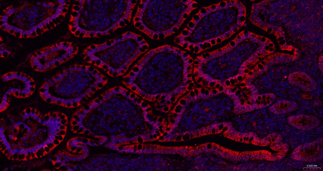 ITPK1 Antibody in Immunohistochemistry (Paraffin) (IHC (P))