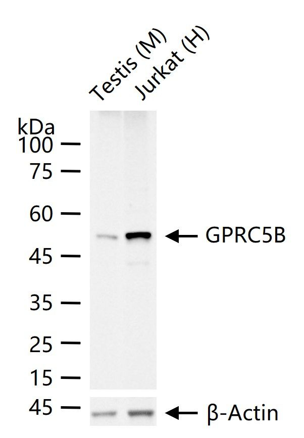 GPRC5B Antibody in Western Blot (WB)