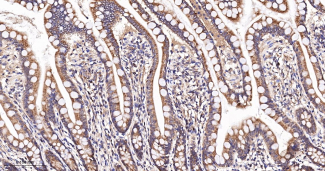 PEX11B Antibody in Immunohistochemistry (Paraffin) (IHC (P))