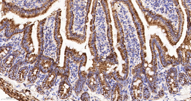 MDH2 Antibody in Immunohistochemistry (Paraffin) (IHC (P))