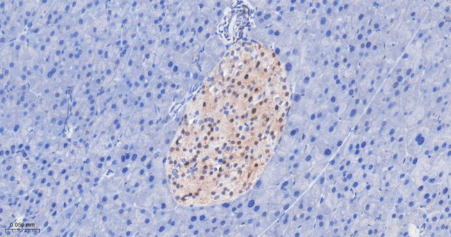 IFT88 Antibody in Immunohistochemistry (Paraffin) (IHC (P))