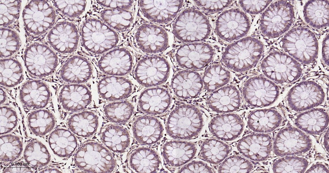 RAB8A Antibody in Immunohistochemistry (Paraffin) (IHC (P))