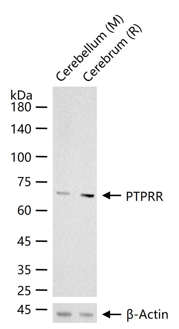 PCPTP1 Antibody in Western Blot (WB)