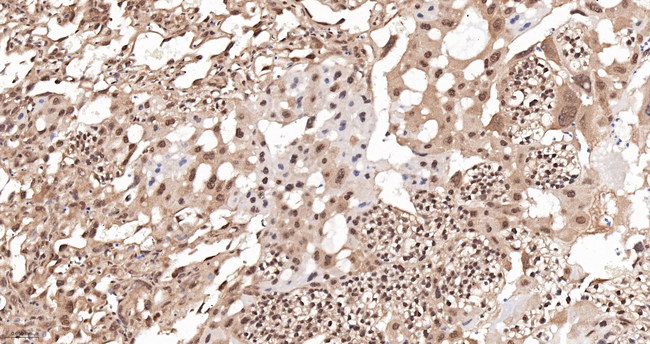 PPP2R5D Antibody in Immunohistochemistry (Paraffin) (IHC (P))