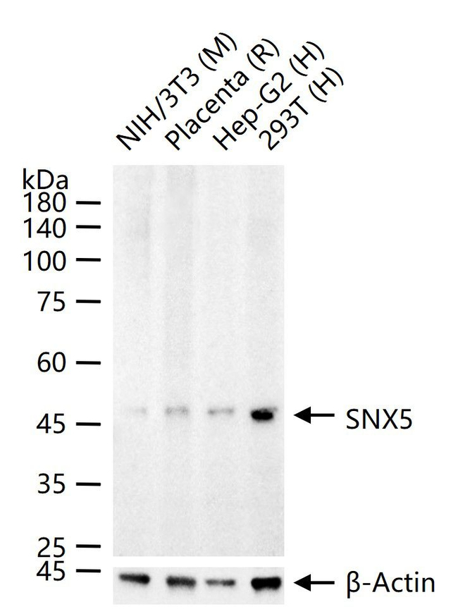 SNX5 Antibody in Western Blot (WB)