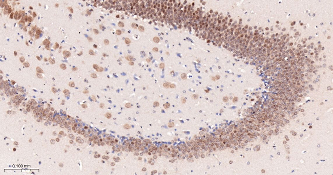 PCBP2 Antibody in Immunohistochemistry (Paraffin) (IHC (P))