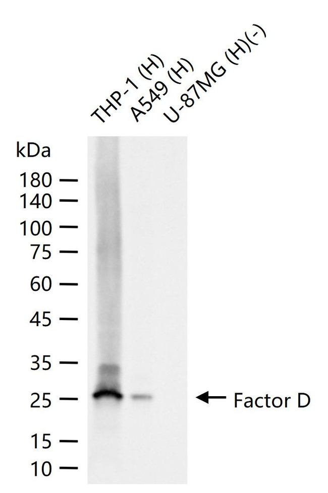 Factor D Antibody in Western Blot (WB)